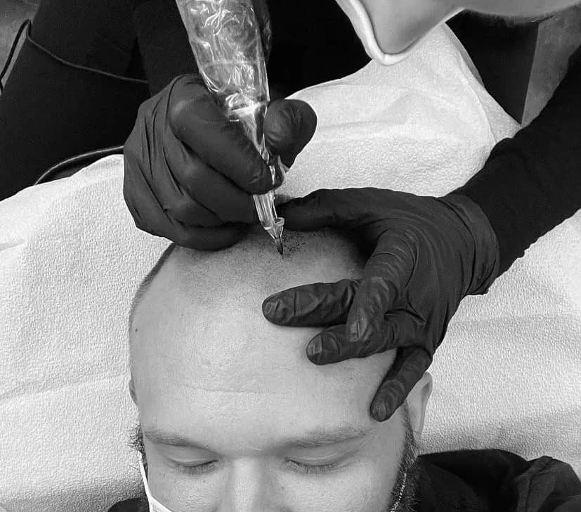 Alberta Micro-Pigmentation Clinic - Scalp Micro-Pigmentation (SMP) — scalp micropigmentation studio in Sherwood Park