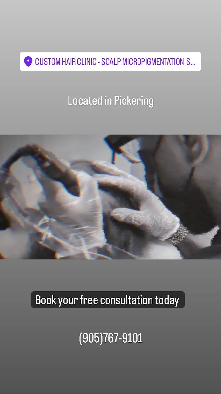 Custom Hair Clinic - Scalp Micropigmentation (SMP) Appointment Only — scalp micropigmentation studio in Pickering