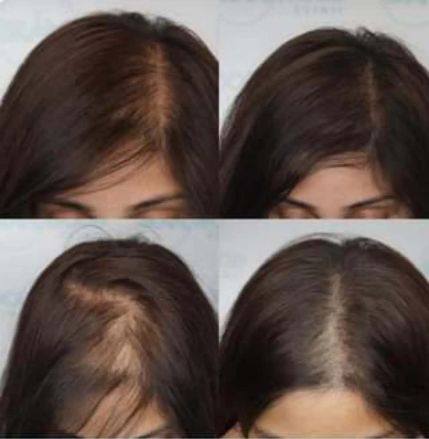 Fuller Scalp — scalp micropigmentation studio in Mississauga