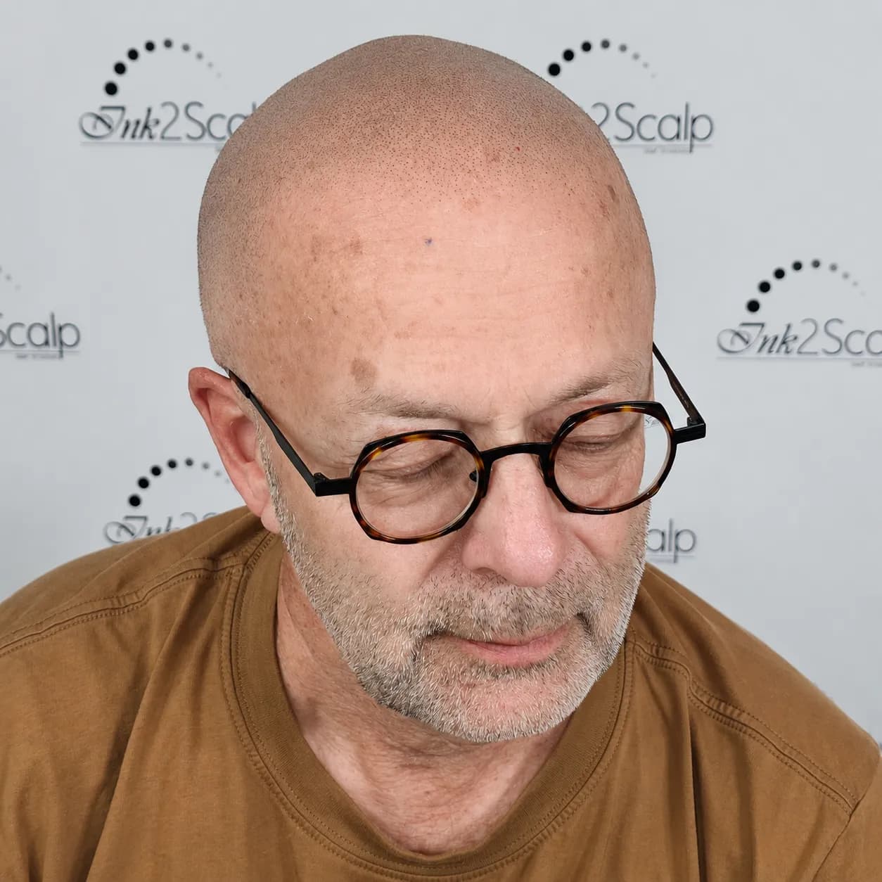 Ink2Scalp SMP Studio — scalp micropigmentation studio in Whitby