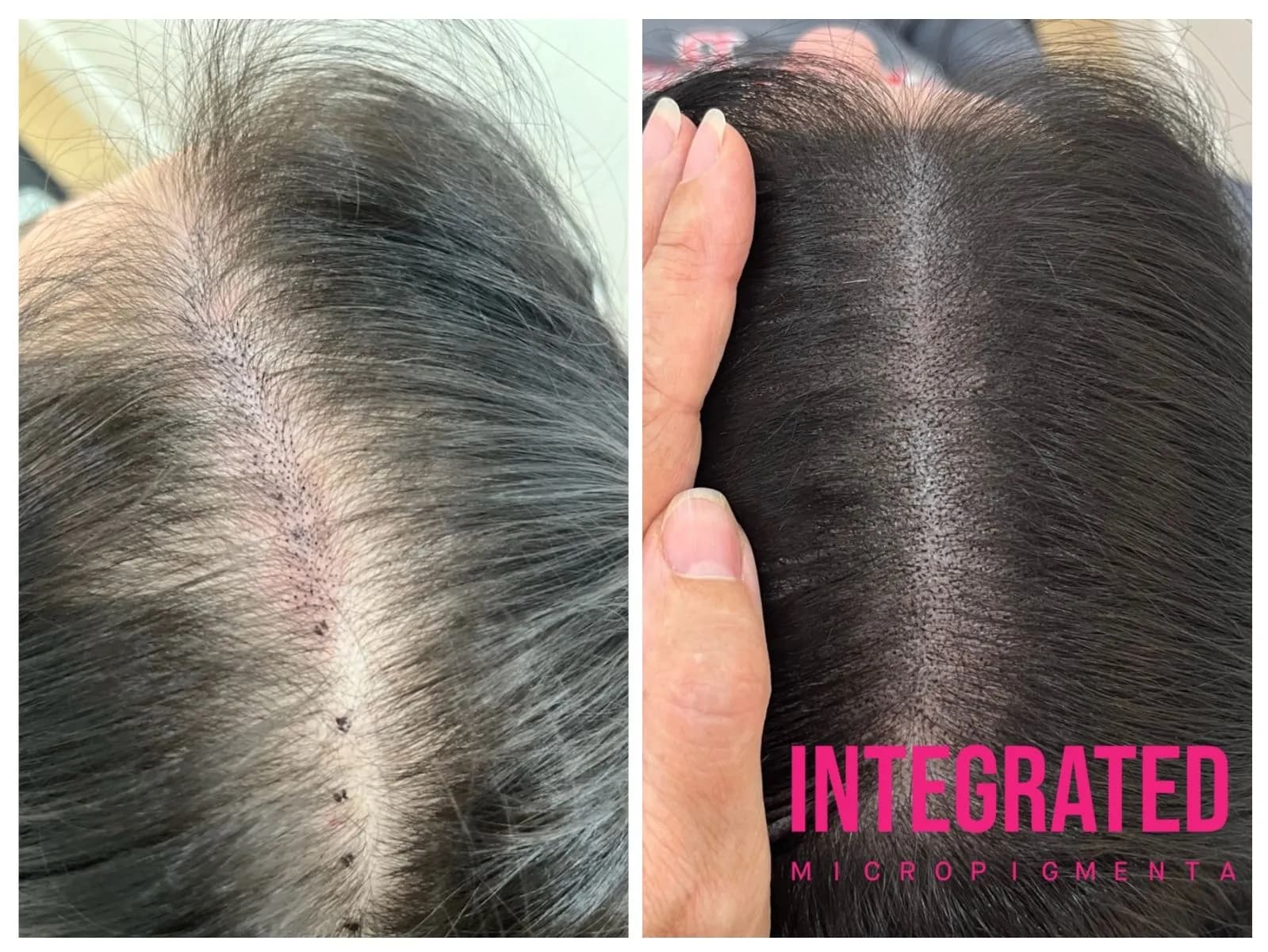 Integrated Ink SMP Micropigmentation — scalp micropigmentation studio in Port Moody