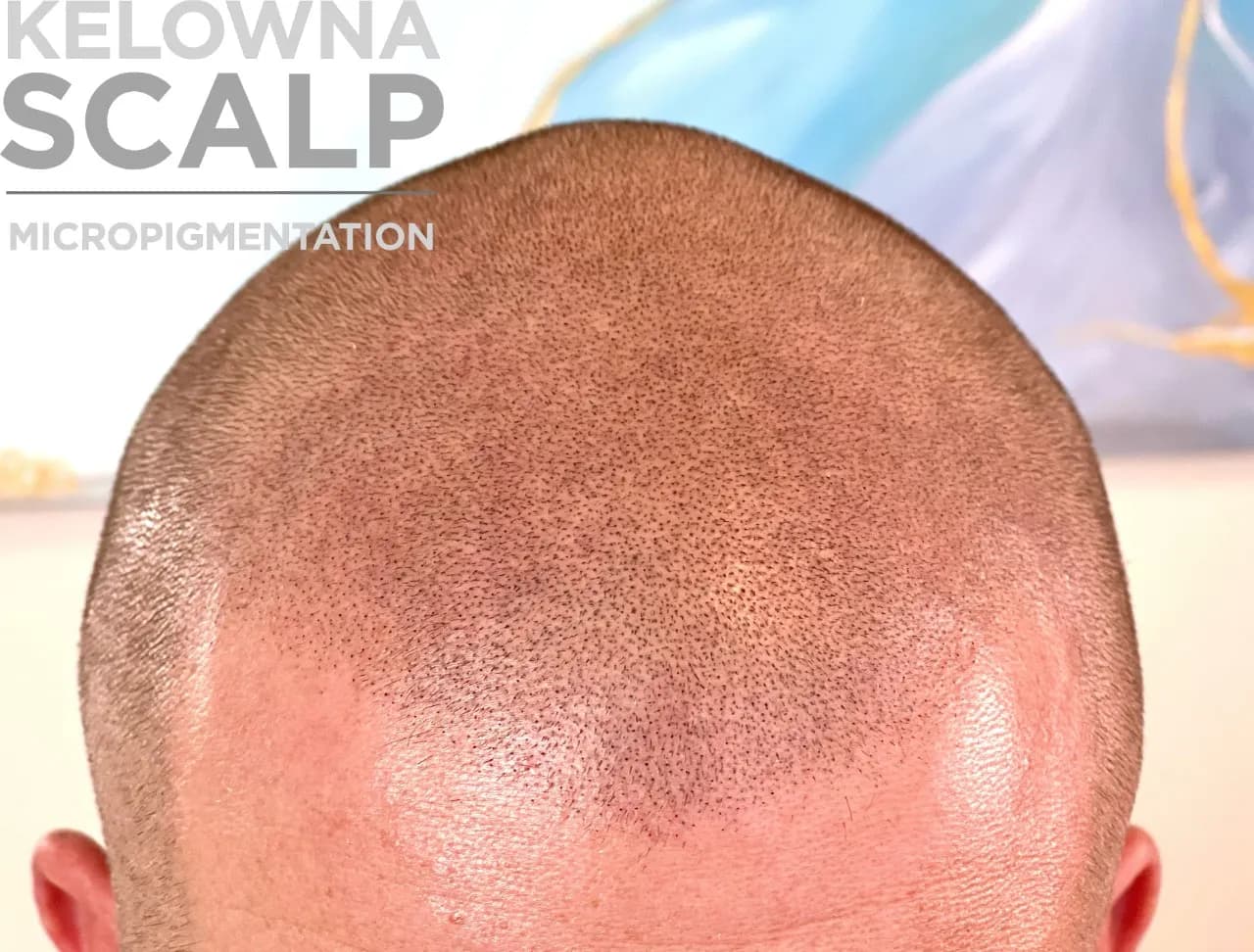 Kelowna Scalp Micropigmentation — scalp micropigmentation studio in Kelowna