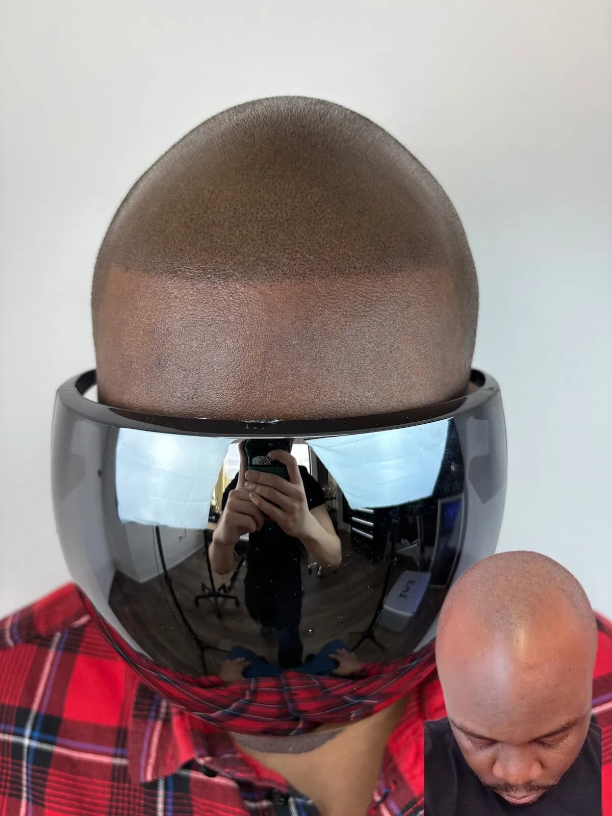 MicroMaxxing SMP | Scalp Micropigmentation — scalp micropigmentation studio in Pickering