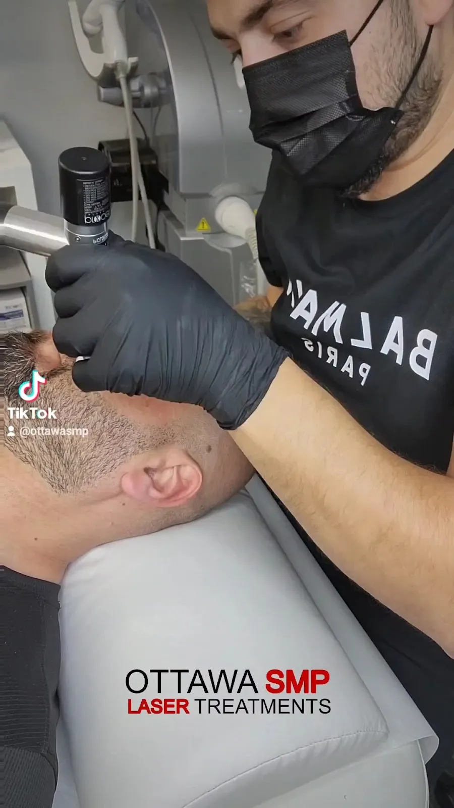 Ottawa Scalp Micropigmentation & Laser Hair Removal — scalp micropigmentation studio in Ottawa