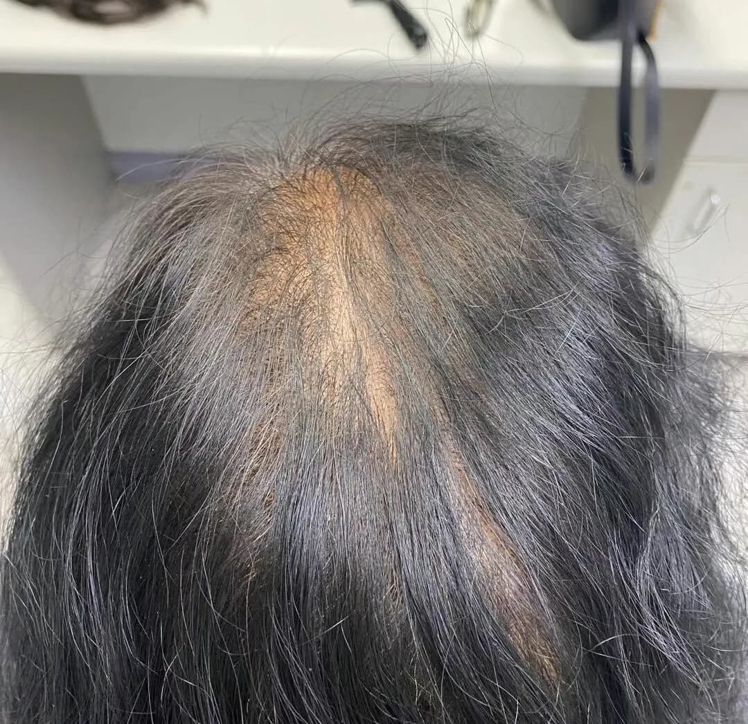 Refine Scalp Studio — scalp micropigmentation studio in Abbotsford