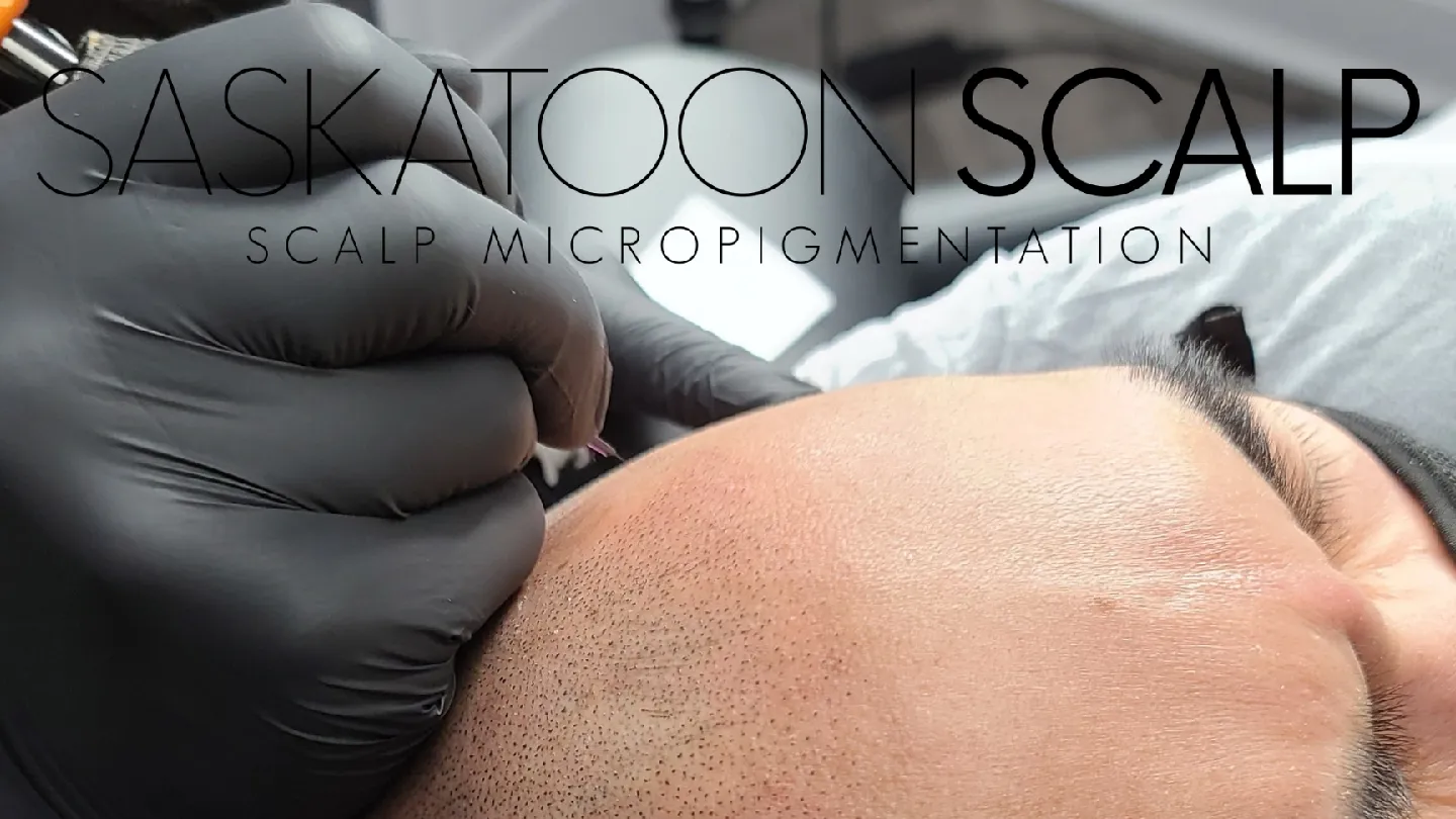 Saskatoon Scalp - Scalp Micropigmentation — scalp micropigmentation studio in Saskatoon