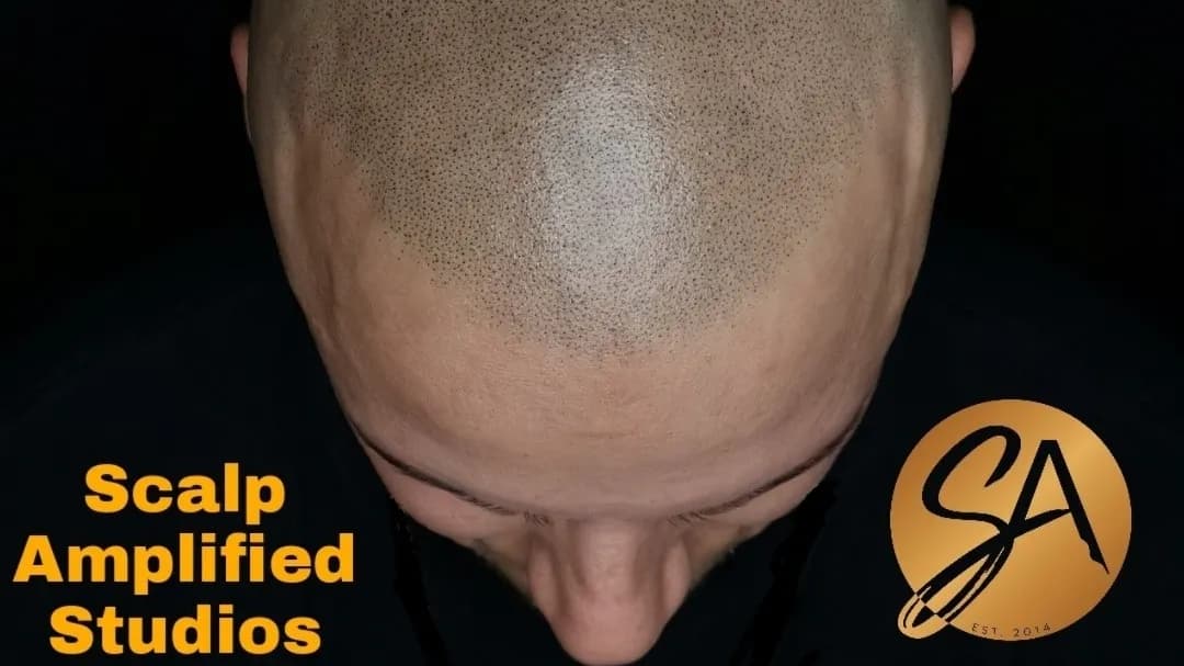 Scalp Amplified Studios| SMP | Scalp micropigmentation — scalp micropigmentation studio in Oakville