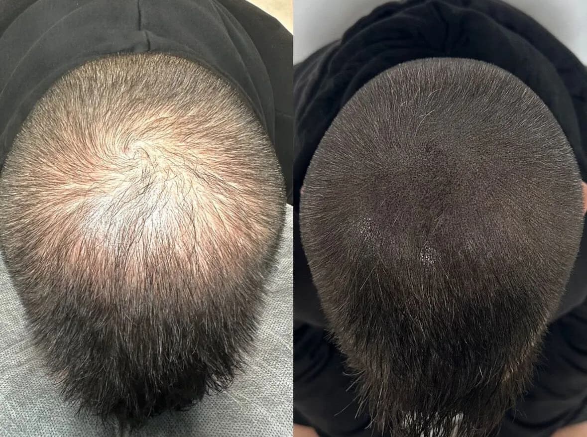 Scalp and Skin Studio — scalp micropigmentation studio in Richmond Hill