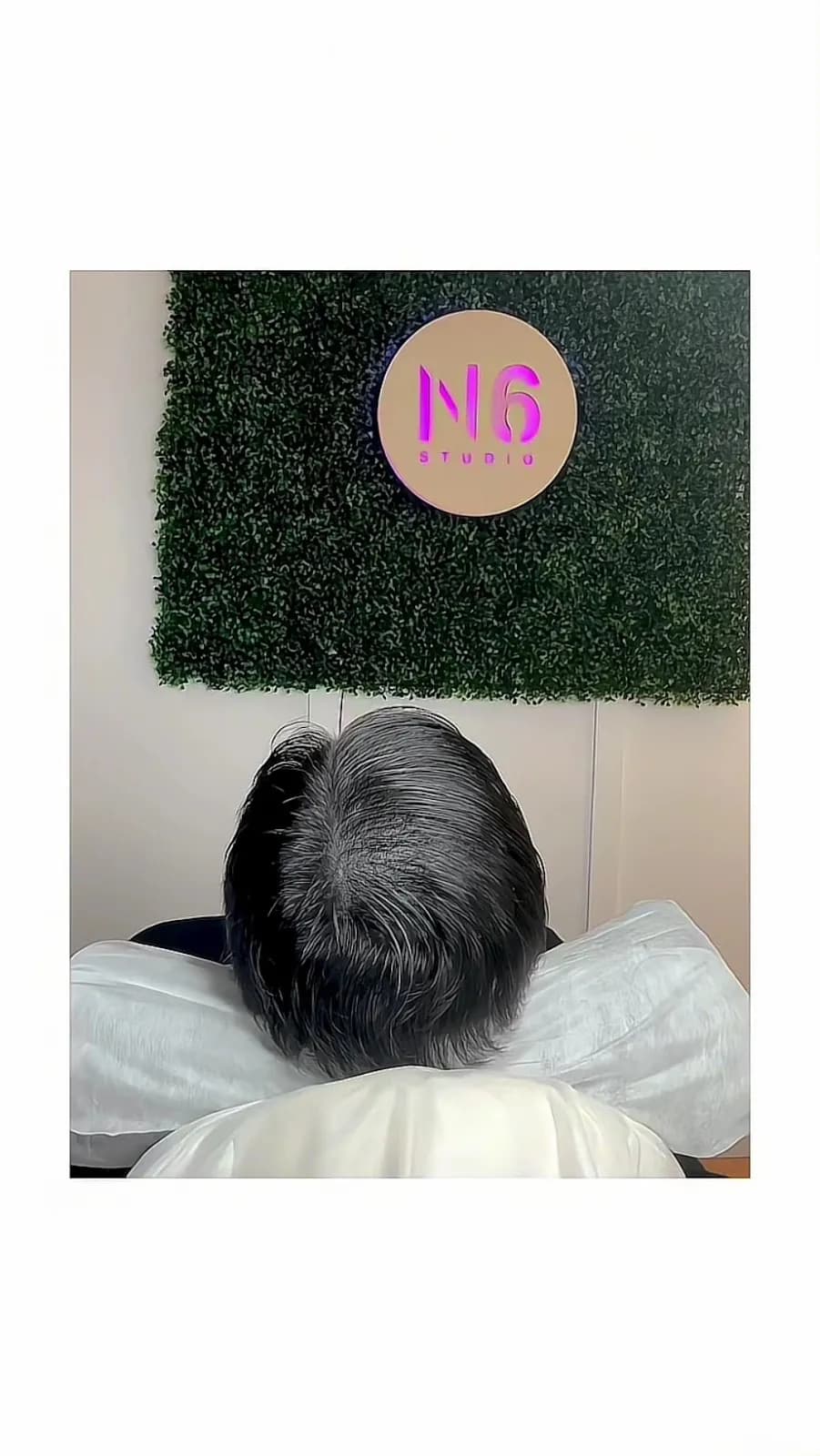 STUDIO N6 - Vancouver SMP by Sana — scalp micropigmentation studio in Port Moody