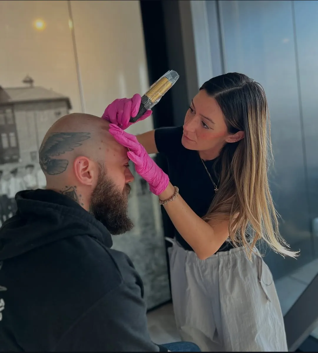 YYC Scalp Micropigmentation (SMP) — scalp micropigmentation studio in Calgary